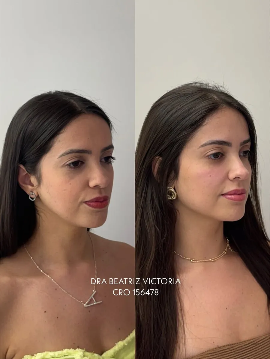 Caso Full Face 3/4